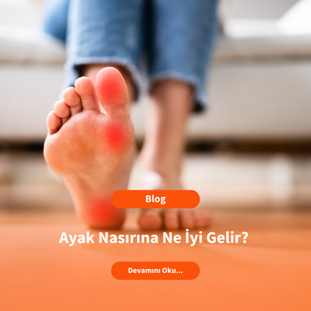 Ayak Nasırına Ne İyi Gelir?